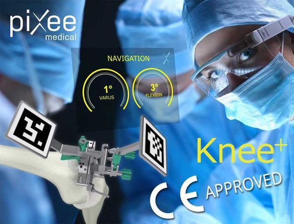 Smart Glasses on a Path to Become a Staple of Orthopedic Surgeries